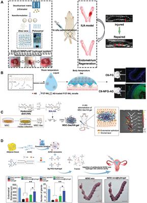 Recent progress of Bioinspired Hydrogel-based delivery system for endometrial repair